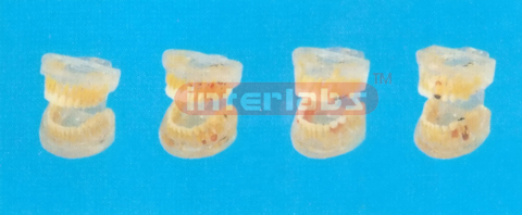 TRANSPARENT ADULT TOOTH MODEL